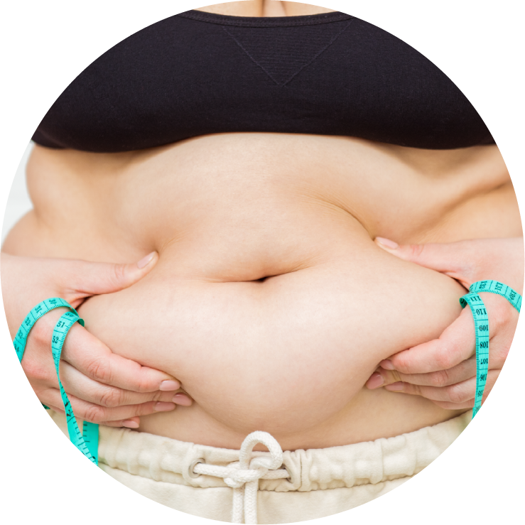 Bariatric surgery marketing